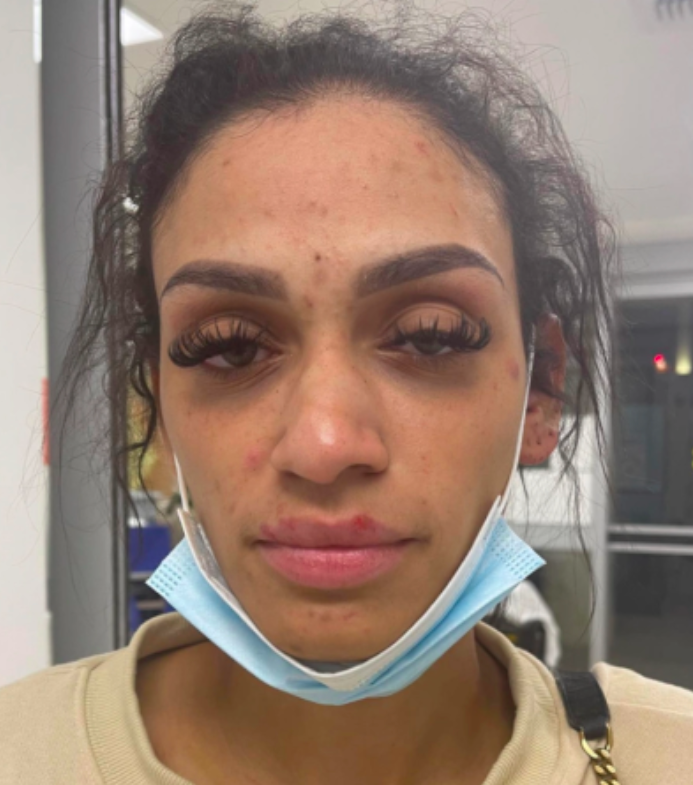 Charlotte Hornets Miles Bridges Faces 3 Felony Domestic Violence Charges for Assault and Abuse – Miles Bridges, NBA restricted free agent most known for playing with the Charlotte Hornets, is facing three accounts of domestic violence charges after allegedly assaulting his girlfriend in front of their two children.